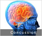 brain concussion