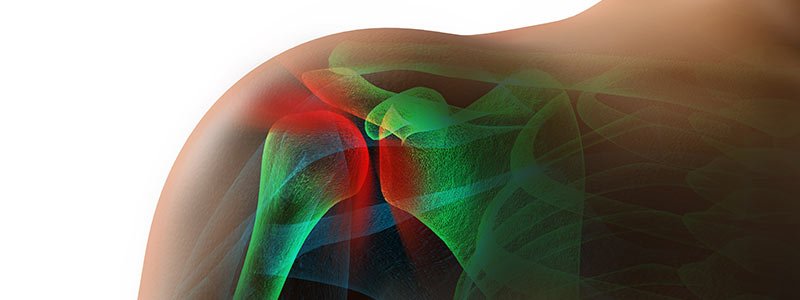 Suffering from Shoulder Pain? There are Treatment Options