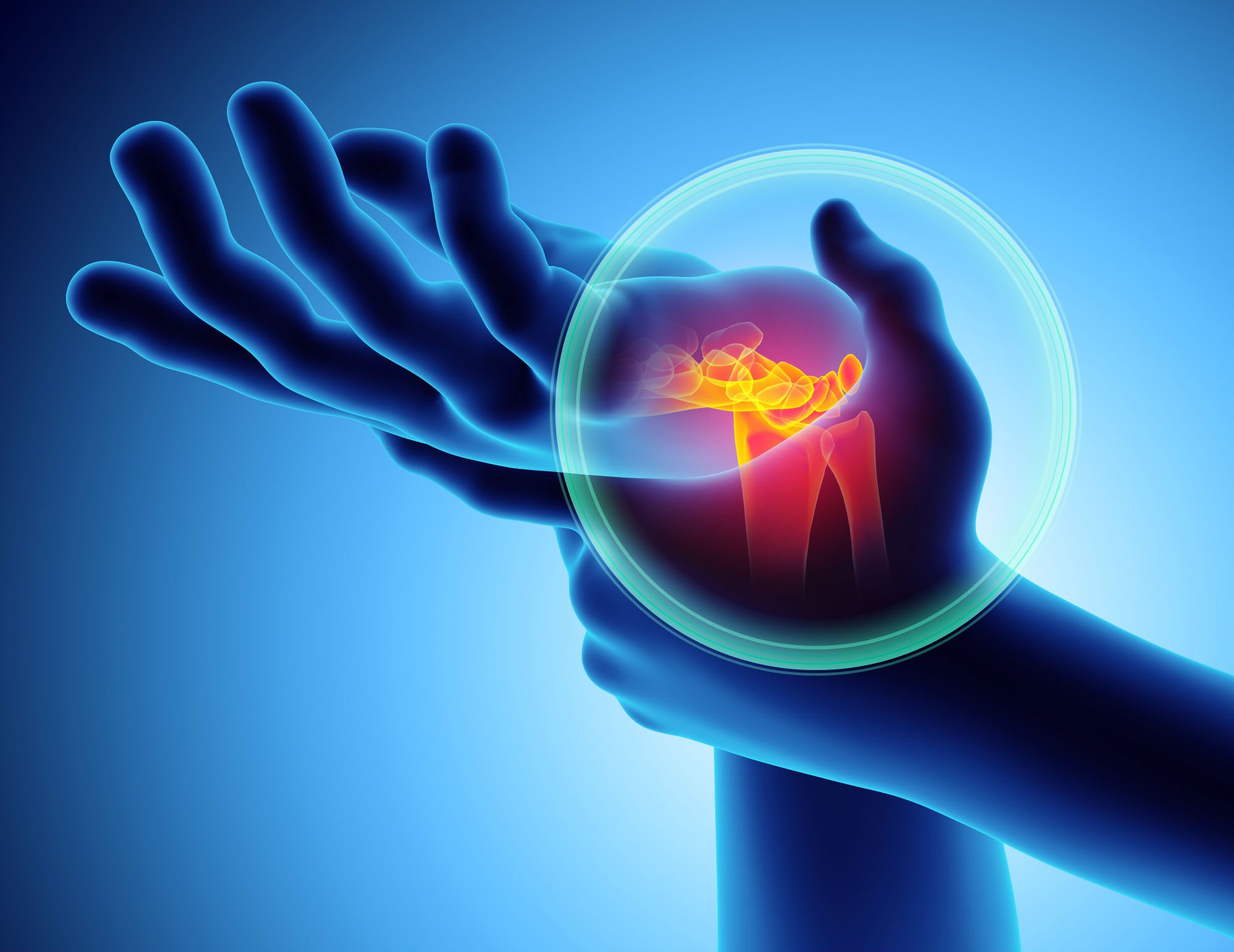 Hand & Upper Extremity Injury Care – Treating All Conditions