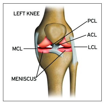 常見的膝蓋外翻傷害包含ACL 前十字韌帶、MCL 內側副韌帶、半月板 Meniscus