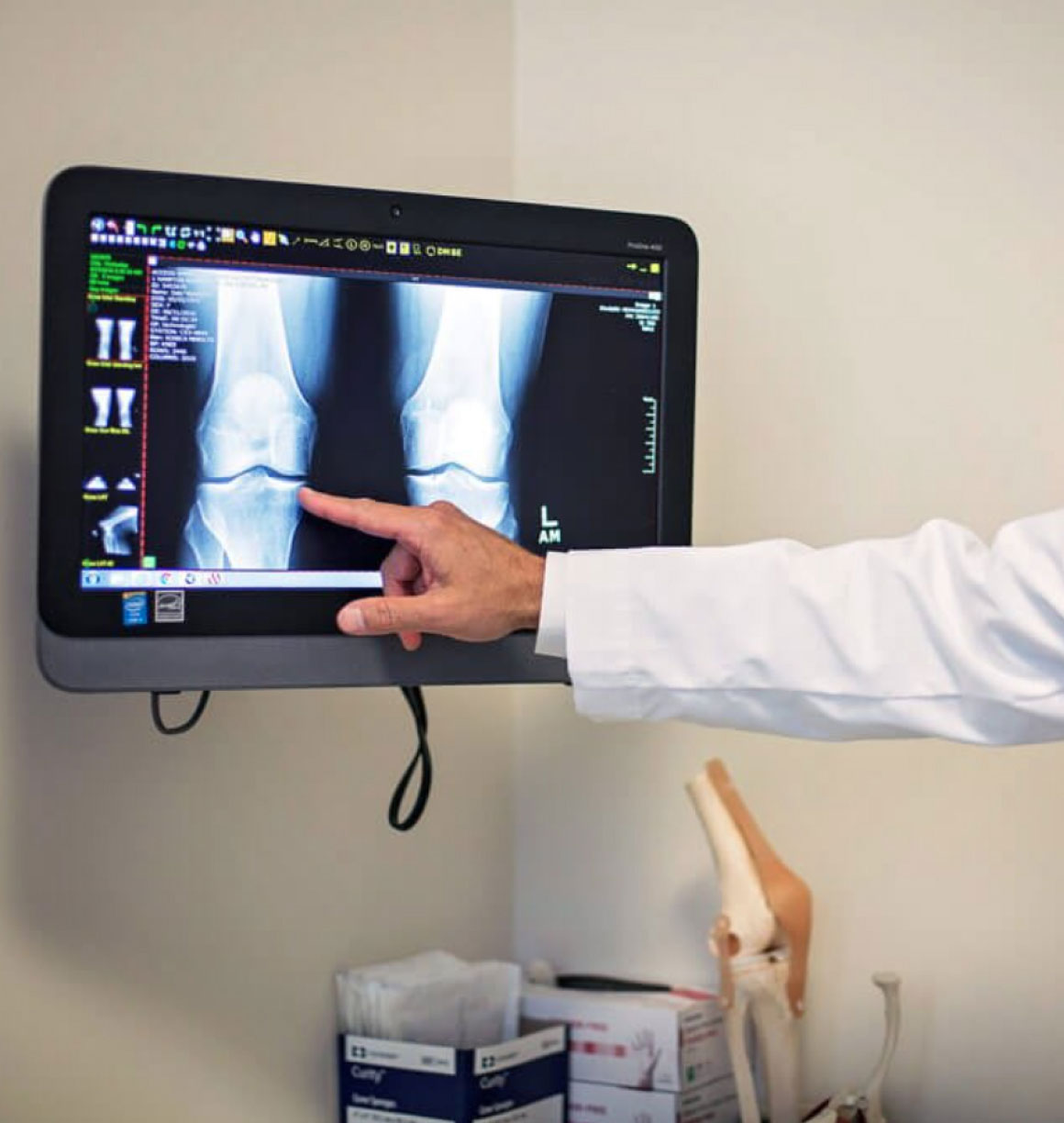 pointing at xray