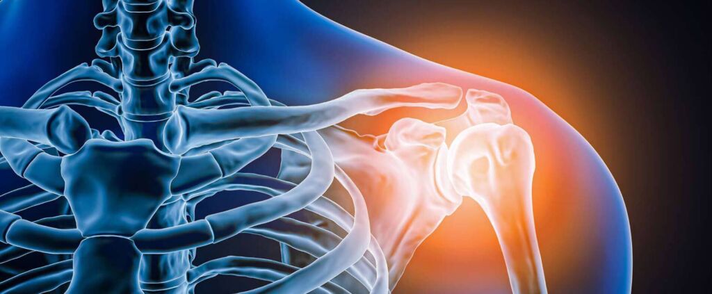 shoulder surgery in NH at Access Sports Medicine