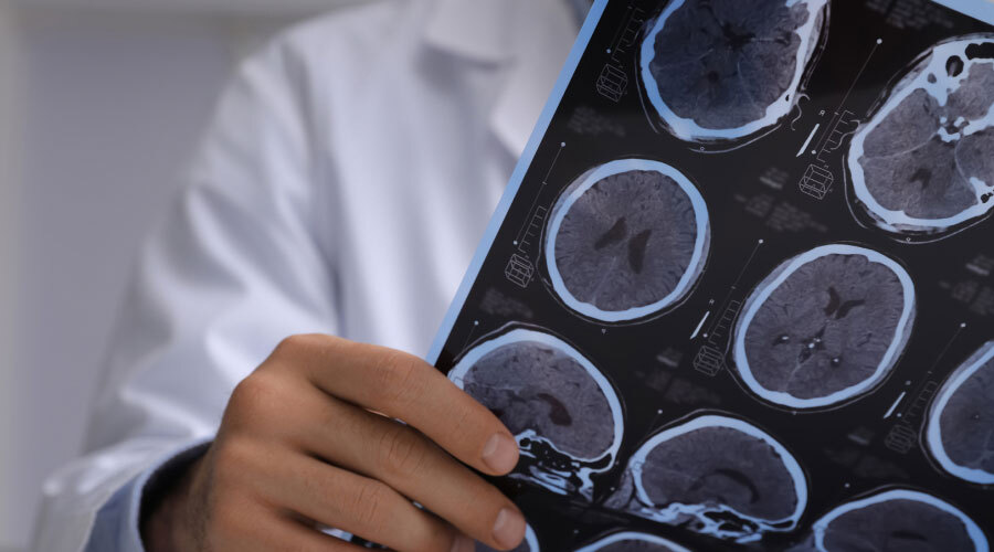 Doctor holding concussion testing results.